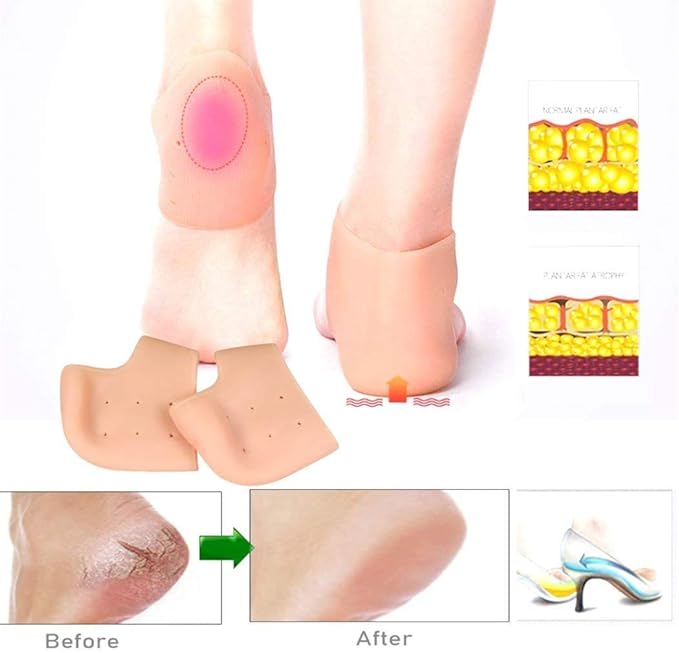 Heel Pain Relief Silicone Gel Heel Protector Socks - CL-MA-1677 Secondary image